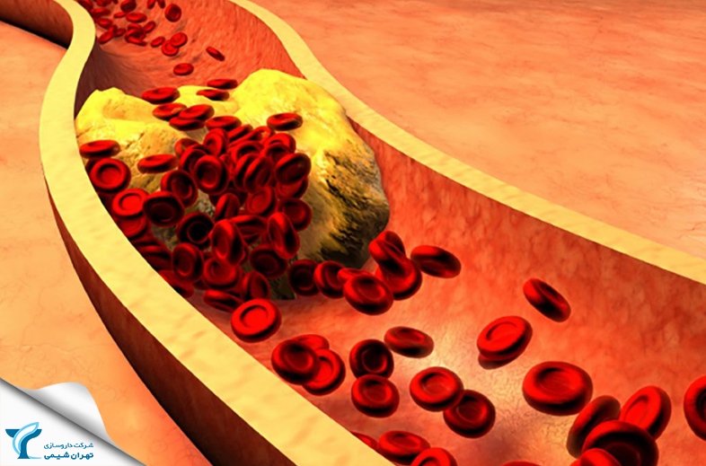 چه عواملی منجر به بروز بیماری عروق کرونری قلب می شوند؟