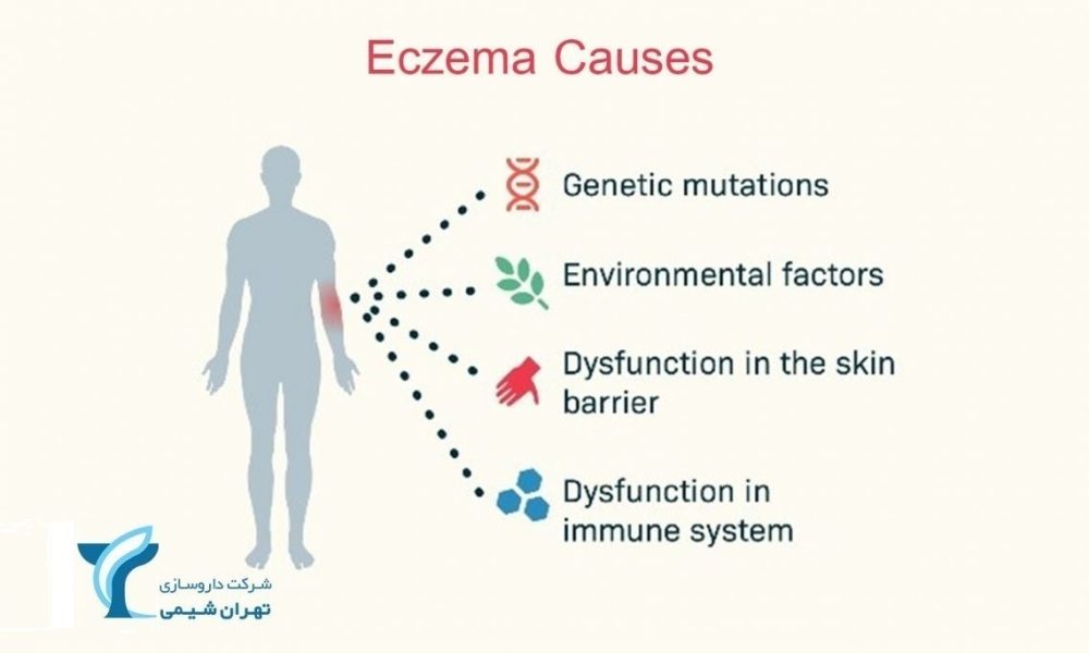 ECZEMA-1170x684-3